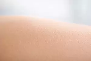 کازمتولوژی چیست و چه نقشی در حفظ بهداشت پوست دارد؟